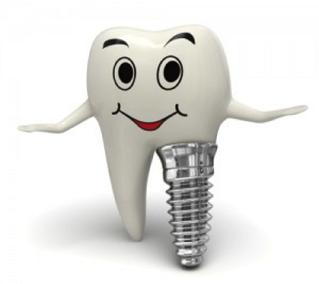 Dental-Implant